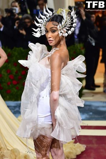 Winnie Harlow